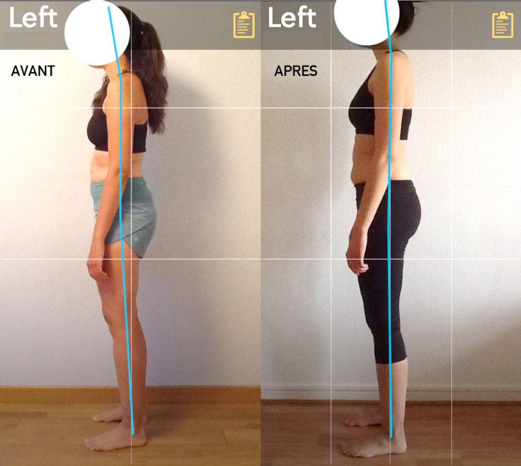 correction de votre posture avec la méthode Egoscue au cabinet Alipos
