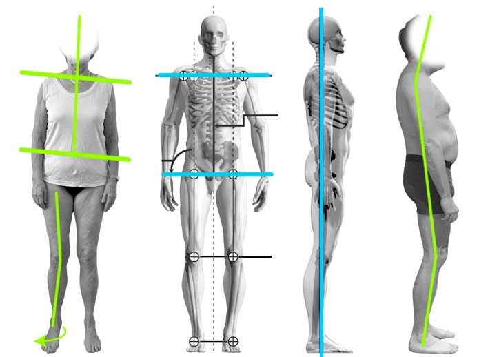 Quelle méthode pour avoir plus d'équilibre dans la marche ?